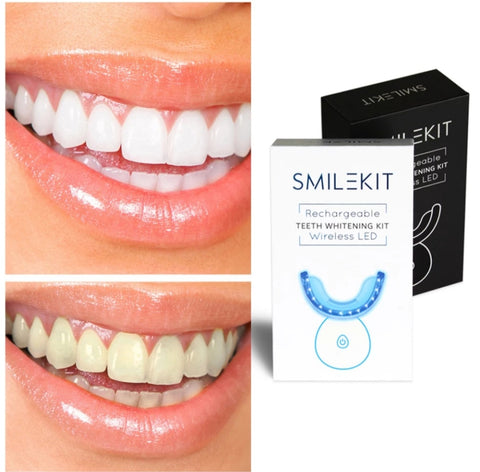 Glow White Teeth Whitening Smile Bright Kit